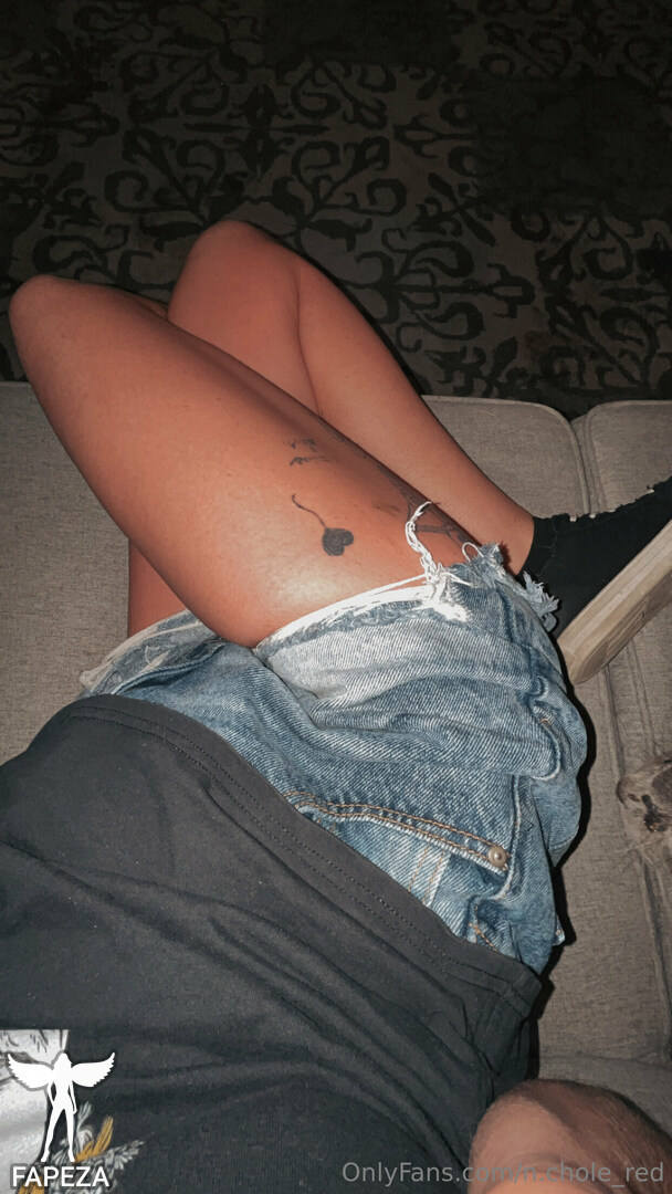 n.chole_red
